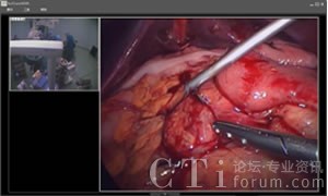 ��ǻ�R���g����